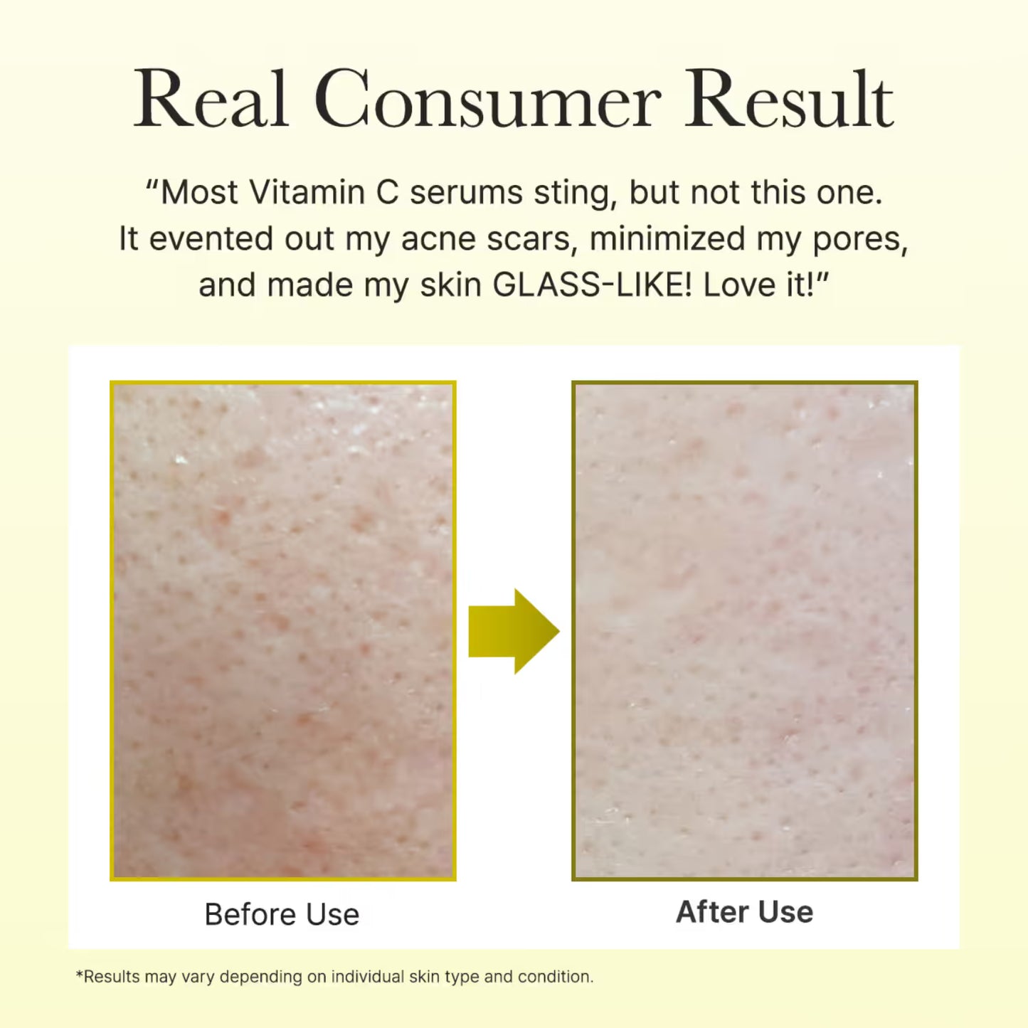 Arencia Face and Eye Cream Vitamin C Booster Shot (30 ml)